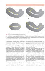 Стандартизация ультразвукового исследования миометрия и эндометрия (MUSA, IETA) - Фото 5