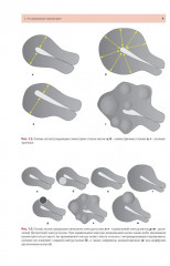 Стандартизация ультразвукового исследования миометрия и эндометрия (MUSA, IETA) - Фото 6