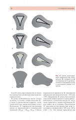 Стандартизация ультразвукового исследования миометрия и эндометрия (MUSA, IETA) - Фото 8