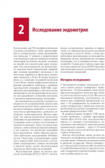 Стандартизация ультразвукового исследования миометрия и эндометрия (MUSA, IETA) - Фото 10
