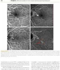 ОКТ-ангиография. Клинический атлас - Фото 1
