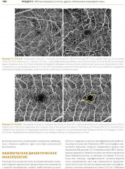 ОКТ-ангиография. Клинический атлас - Фото 2