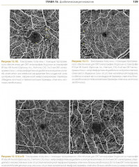 ОКТ-ангиография. Клинический атлас - Фото 3