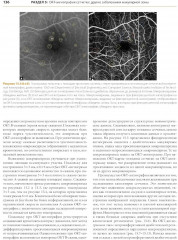 ОКТ-ангиография. Клинический атлас - Фото 5