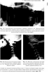 Травматология детского возраста - Фото 3