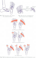 Травматология детского возраста - Фото 7