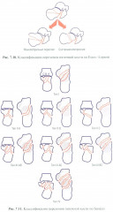 Травматология детского возраста - Фото 8