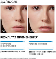 Крем для склонной к акне кожи увлажняющий «Moist & Heal Anti-Acne Cream» - Фото 2