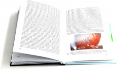 Клиническая ревматология. Клиника, диагностика и принципы лечения основных ревматических болезней. Клинические случаи клиники факультетской терапии им. С. П. Боткина. Комплект из 3 книг - Фото 8