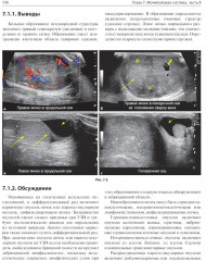 Детская радиология. Сложные случаи - Фото 9
