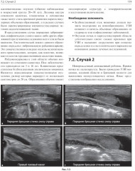 Детская радиология. Сложные случаи - Фото 10