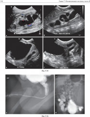 Детская радиология. Сложные случаи - Фото 12