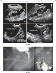 Детская радиология. Сложные случаи - Фото 14