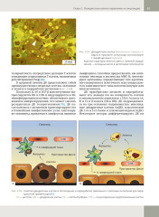 Гепатология. Клиническая морфология печени. Практическое руководство для врачей - Фото 10