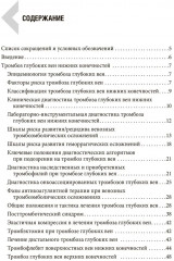 Венозные тромбоэмболические осложнения. Антикоагулянтная терапия в таблицах и схемах - Фото 1