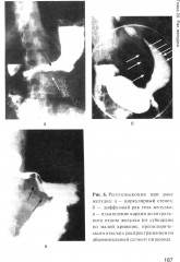 Онкология - Фото 9