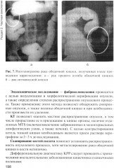 Онкология - Фото 11