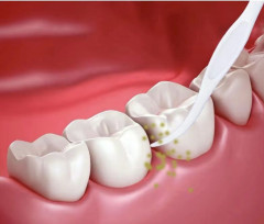 Флоссеры «High Tensile Dental Floss» - Фото 2