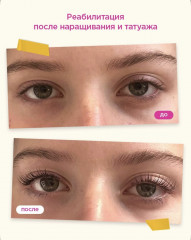 Сыворотка для ресниц и бровей - Фото 10