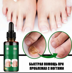 Жидкость для лечения грибка ногтей и восстановления ногтевой пластины - Фото 4