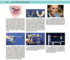 Атлас оперативной черепно-лицевой хирургии - Фото 10
