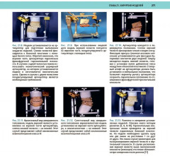 Атлас оперативной черепно-лицевой хирургии - Фото 11