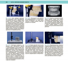 Атлас оперативной черепно-лицевой хирургии - Фото 12