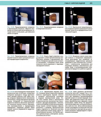 Атлас оперативной черепно-лицевой хирургии - Фото 13