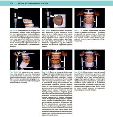 Атлас оперативной черепно-лицевой хирургии - Фото 14