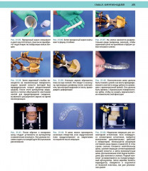 Атлас оперативной черепно-лицевой хирургии - Фото 15