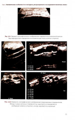 УЗИ в маммологии. Руководство для врачей - Фото 10