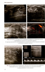УЗИ в маммологии. Руководство для врачей - Фото 11