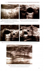 УЗИ в маммологии. Руководство для врачей - Фото 12