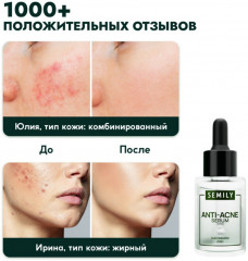 Сыворотка для лица против акне с ниацинамидом «Anti-Acne Serum» - Фото 3