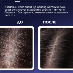Пилинг для очищения кожи головы от перхоти отшелушивающий - Фото 2