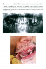 Ситуационные задачи по челюстно-лицевой хирургии: учебное пособие - Фото 14