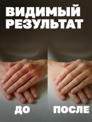 Мазь монастырская от псориаза - Фото 4