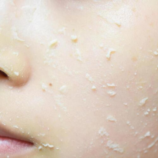 Пилинг-гель для лица с AHA-BHA кислотами энергетический «Vita7 Energy Peeling Gel»