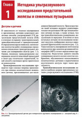 Ультразвуковое исследование предстательной железы - Фото 2