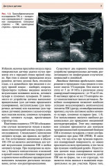 Ультразвуковое исследование предстательной железы - Фото 4
