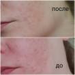 Отзыв на EFFACLAR DUO(+) Корректирующий крем-гель для проблемной кожи от Галина