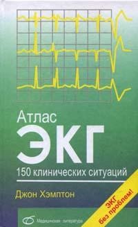 Атлас ЭКГ. 150 клинических ситуаций