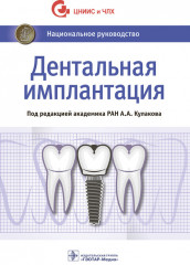 Дентальная имплантация