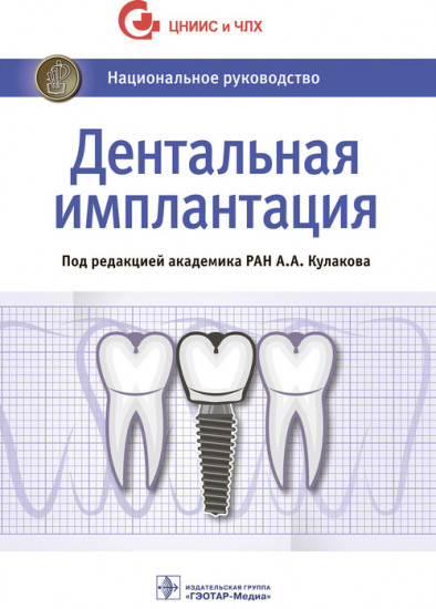 Дентальная имплантация. Национальное руководство