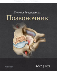 Лучевая диагностика. Позвоночник