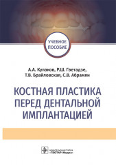 Костная пластика перед дентальной имплантацией