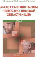 Абсцессы и флегмоны челюстно-лицевой области и шеи