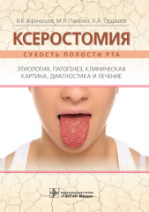 Ксеростомия. Сухость полости рта