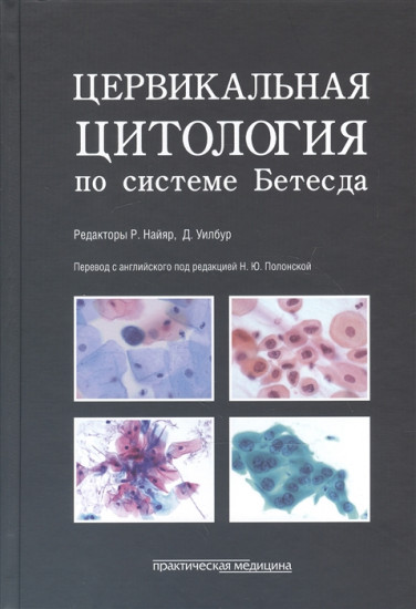 Цервикальная цитология по системе Бетесда. Терминология, критерии и пояснения