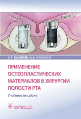 Применение остеопластических материалов